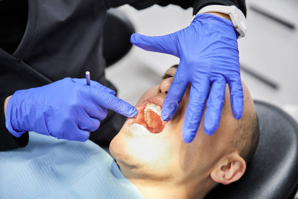 Best Emergency Dental Services for Seniors in Sugar Land, TX