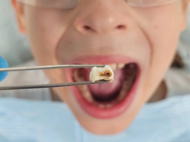 Best Mobile Emergency Dentist in Sugar Land, TX